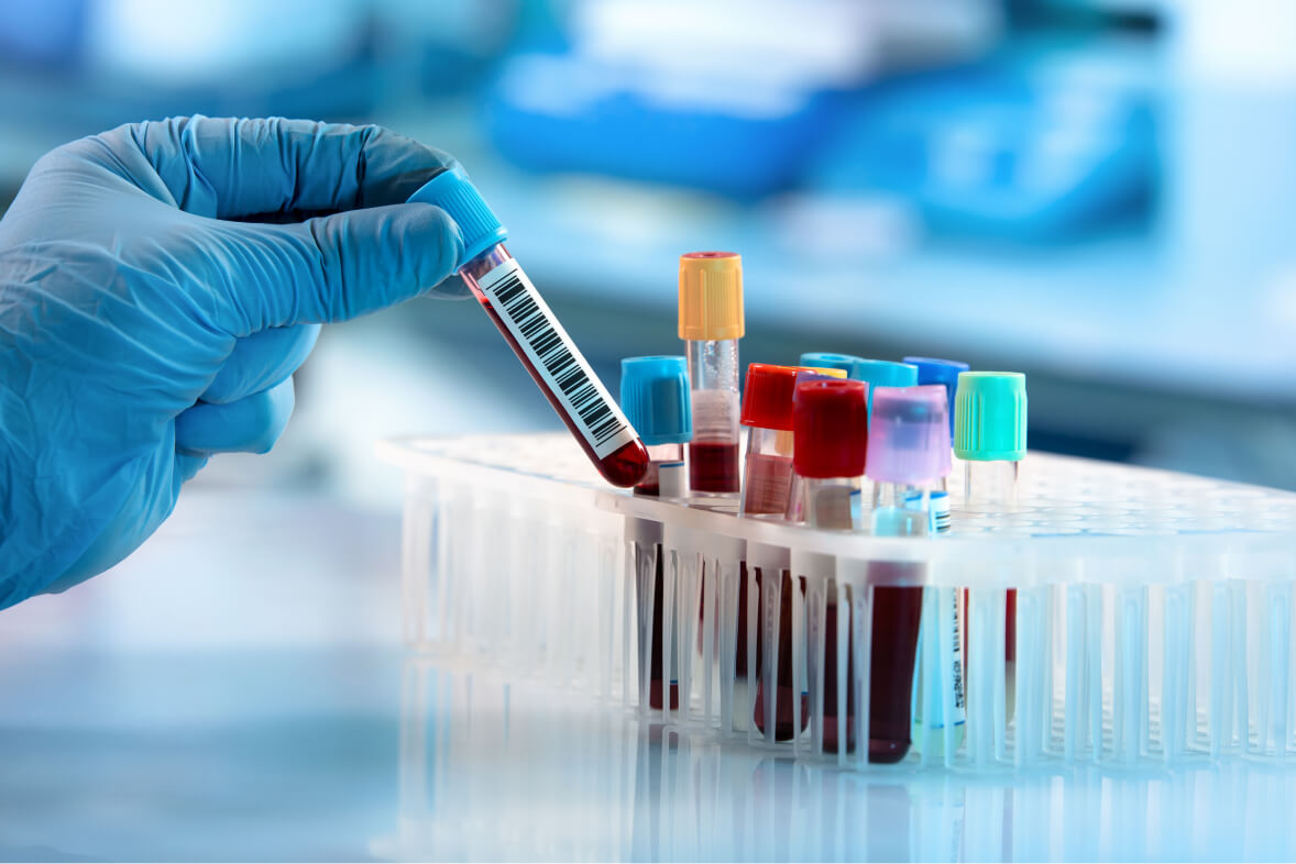 VA Medical Laboratory Testing & Analysis Services